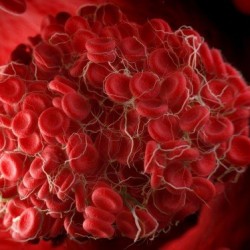 8 групп риска,которым угрожает тромб